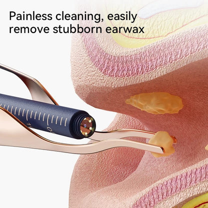 Smart Visual Ear Wax Cleaner with HD Camera – See What You're Doing