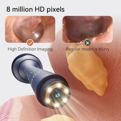 Smart Visual Ear Wax Cleaner with HD Camera – See What You're Doing